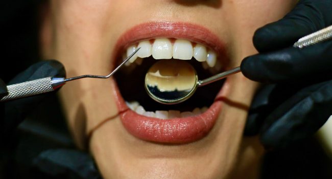 Γενική Οδοντιατρική Γενική Οδοντιατρική