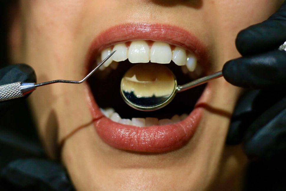 Γενική Οδοντιατρική