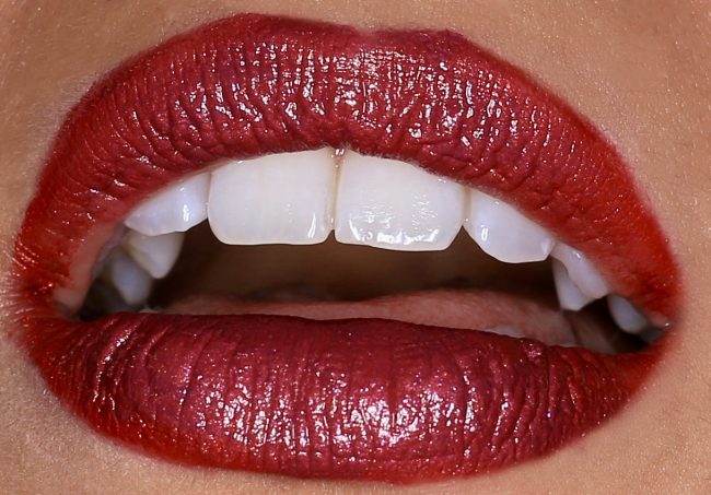 aisthitiki_odontiatriki αισθητική οδοντιατρική